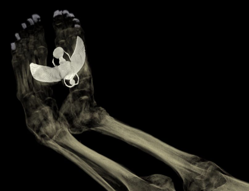 Why You May Want To Think Twice Before Getting A Full-Body Scan