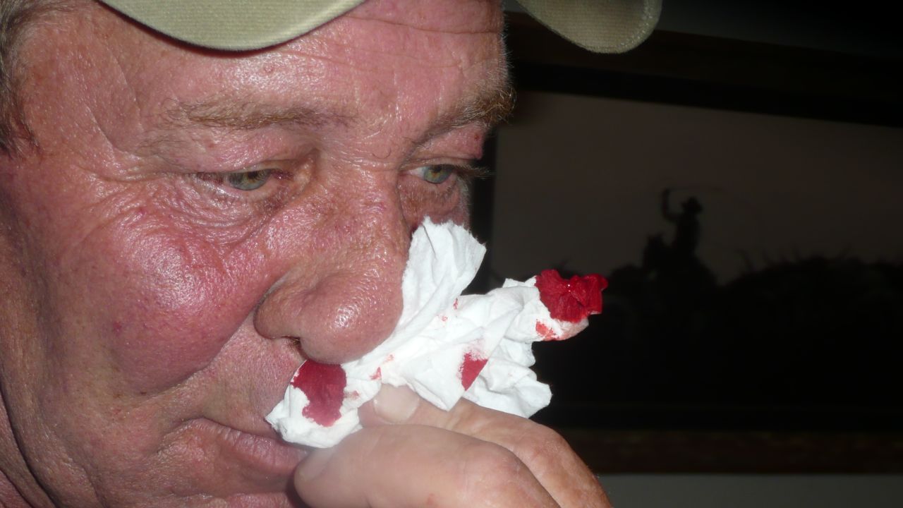 Lisa husband's, Bob, suffered from similar symptoms.