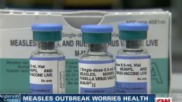 ac dnt elam Measles outbreak _00012313.jpg