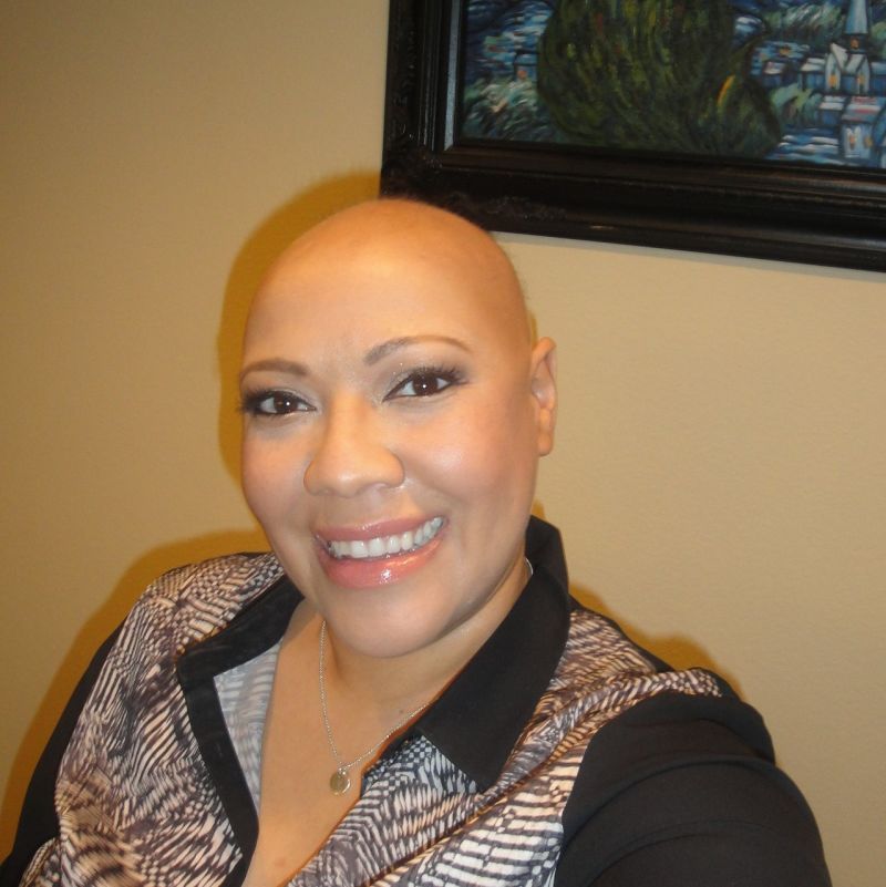 Women With Alopecia on How Hair Loss Affects SelfConfidence  Allure