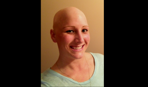 Lauren Crawford, 29, says after being teased as a teenager because of her alopecia, she never thought she would have a husband or child. Now, she has both. "Having my husband say 'You're beautiful without the wig,' that type of encouragement made me start looking at myself thinking, 'Yeah, you're right -- I am!' "