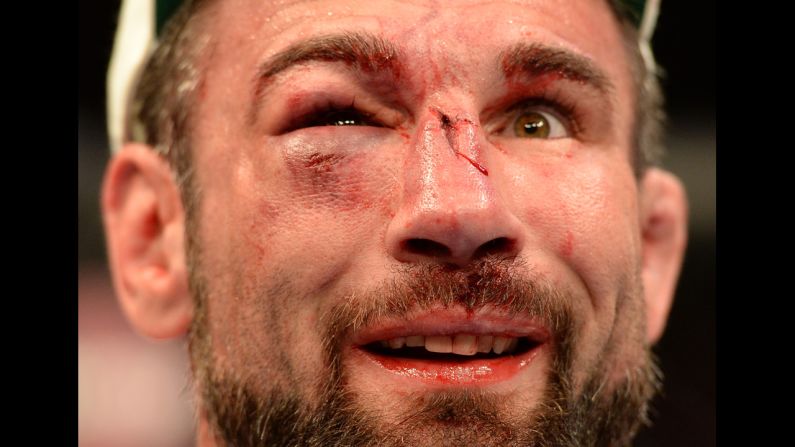 Isaac Vallie-Flagg reacts after the conclusion of his bout against Takanori Gomi during UFC 172, which took place Saturday, April 26, in Baltimore. Gomi won by unanimous decision.