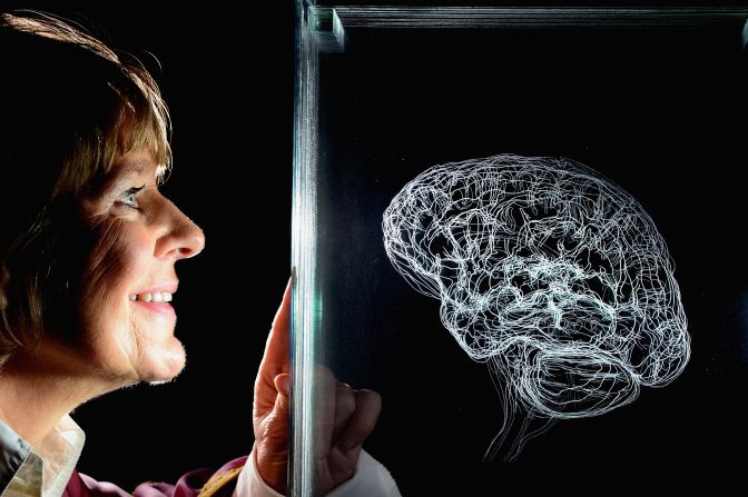 What goes on inside the human mind fascinates Professor Steve Peters -- from sporting stars to those in secure psychiatric units.