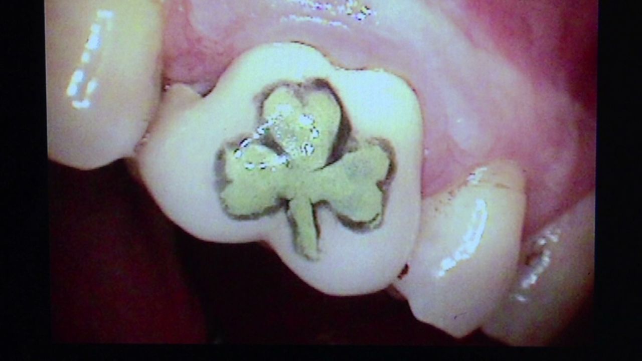 pkg teeth tattoo_00014114.jpg