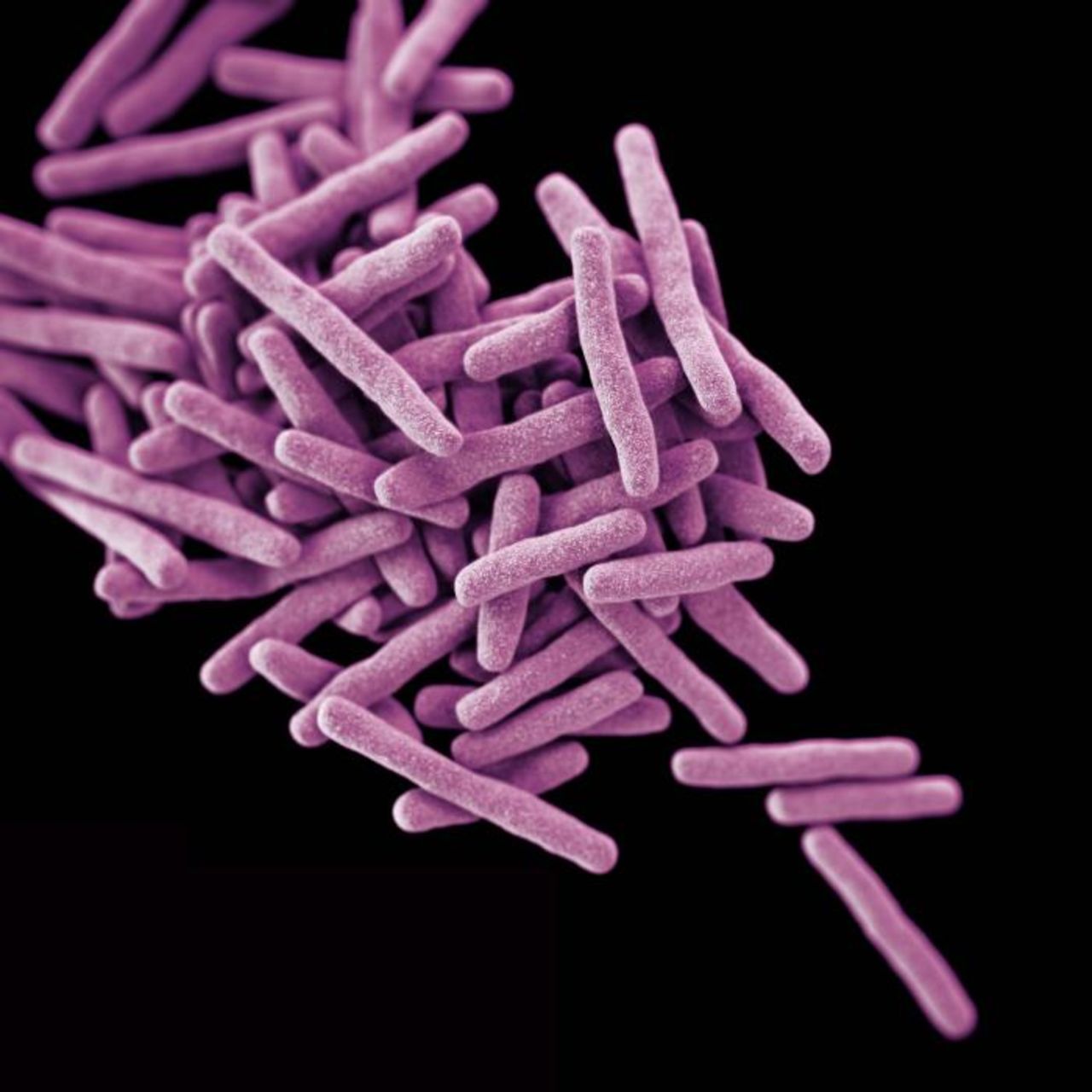 This rendering shows drug-resistant <em>Mycobacterium tuberculosis</em> bacteria, which cause TB. When people with lung TB cough, sneeze or spit, they propel TB bacteria into the air. <br />A third of the world's population has latent TB, which means they have been infected by TB bacteria but are not (yet) ill and cannot transmit the disease.