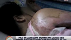 dnt clancy saudi filipino maid burned_00000805.jpg