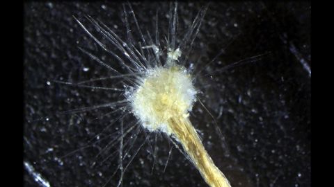 That's not a dandelion, it's a Spiculosiphon oceana -- one of the largest unicellular organisms in the Mediterranean Sea.