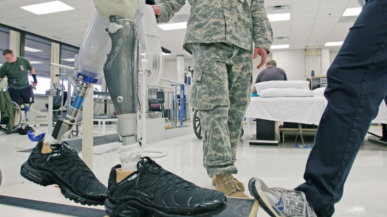 Double amputee Bradley Walker goes through physical therapy to get used to a computerized prosthetic leg.
