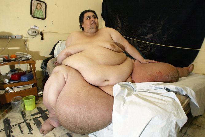Según los récords Guinness, Uribe tenía el registro de mayor peso de una persona viva: pesaba 560 kilos en 2006. Tenía tumores en las piernas.