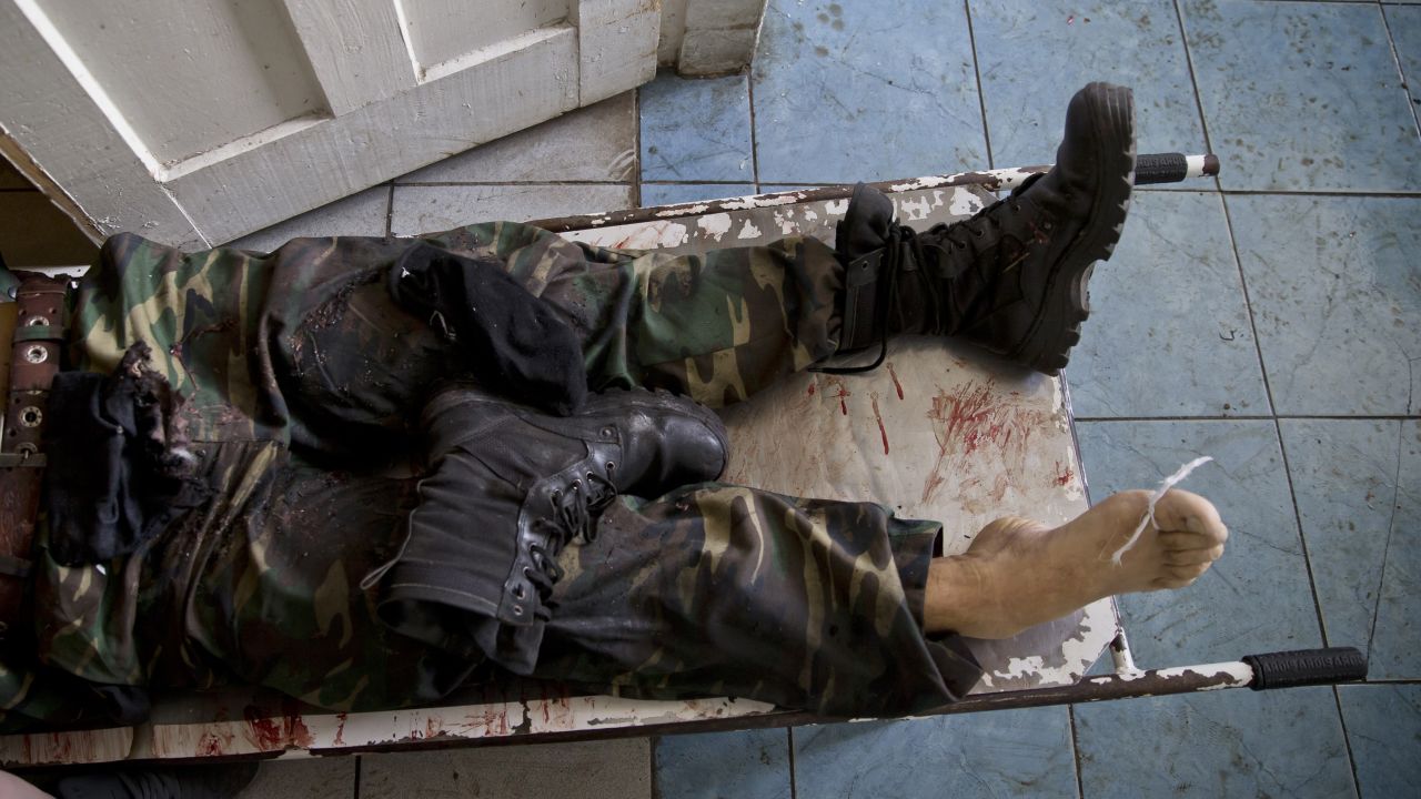 The body of a pro-Russian militant lies on a stretcher at a morgue in Donetsk on May 27. He was killed in clashes around Donetsk's airport, which was seized by pro-Russian separatists a day earlier. Ukrainian forces moved in and reclaimed the facility.