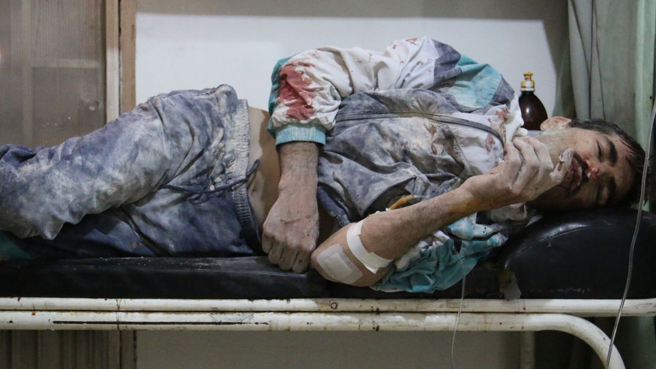An injured man lies in a hospital bed after alleged airstrikes by government forces in Aleppo on Sunday, May 18.