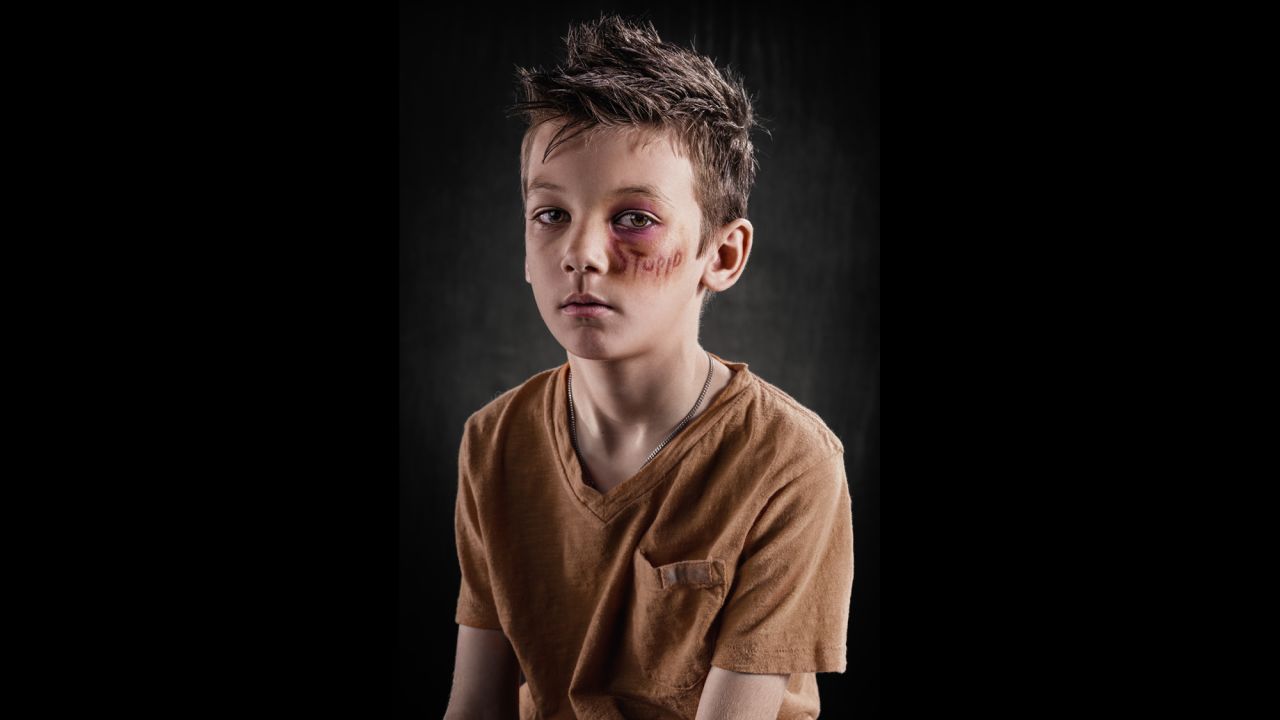In his project about the invisible pain caused by bullying, photographer Rich Johnson had professional makeup artists simulate injuries on children's bodies. The wounds feature a hurtful word -- a word chosen by the participants and their parents.