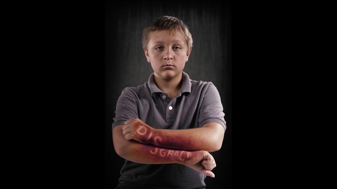 In his project about the invisible pain caused by bullying, photographer Rich Johnson had professional makeup artists simulate injuries on children's bodies. The wounds feature a hurtful word -- a word chosen by the participants and their parents.