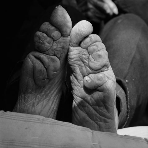 Feet binding started in the Song dynasty and fell out of fashion in the early 20th century when it was banned by the government. "Body modification is in all cultures. We all do something to make ourselves more attractive or to help us feel better. Today, we see surgical toe tucks to beautify the foot, rib removal to make the waist smaller," says Farrell.