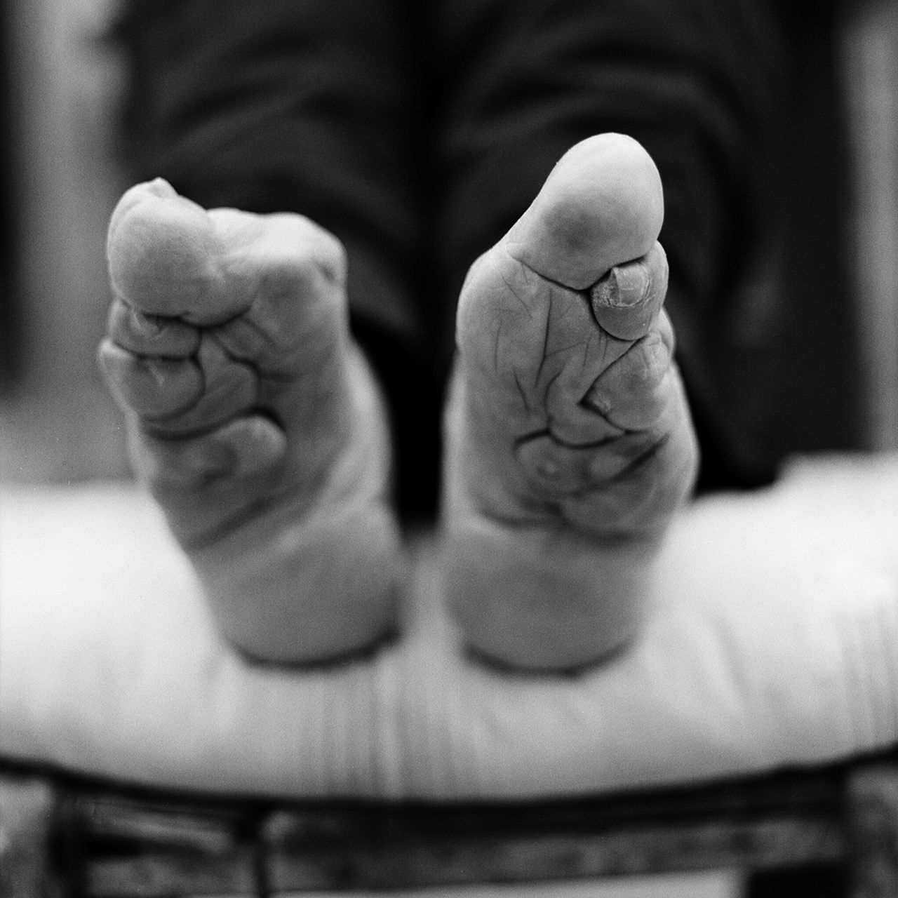 Yang Jinge's feet. "In most cases that I came across in the villages, mothers bound the feet of their daughters, doing it out of love, as they hoped for a better marriage and a better life for their daughters," says Farrell. "About 50% of the feet that I saw were not done very well. A lot of the feet became disfigured and did not achieve the desired shape."