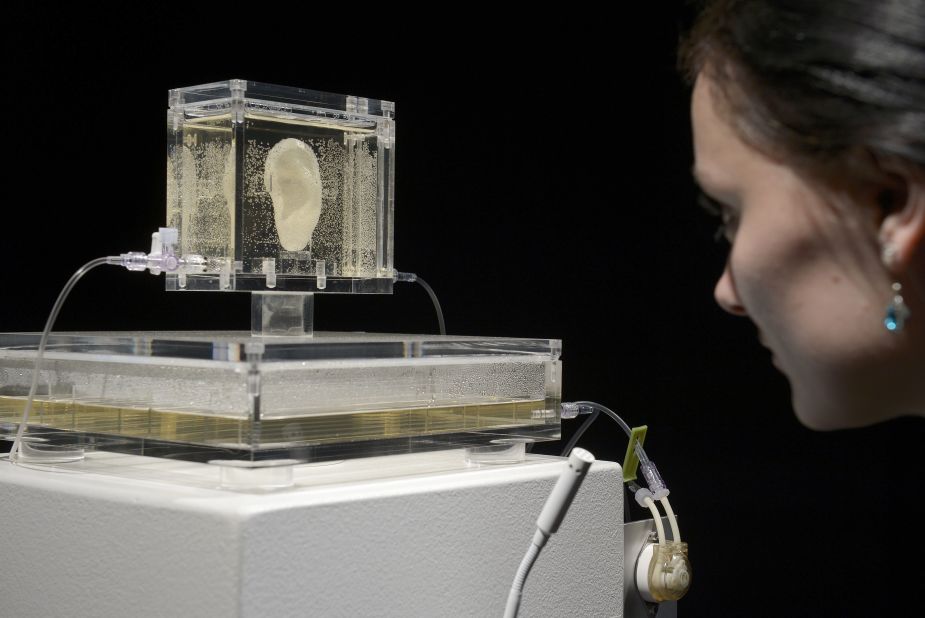 Boston-based artist Diemut Strebe used tissue engineering to create a replica of Vincent Van Gogh's ear. 
