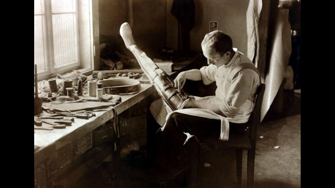 An artificial limb maker at work in Berlin in 1919. Prosthetics were perhaps Berlin's busiest industry after the carnage of the Great War. 