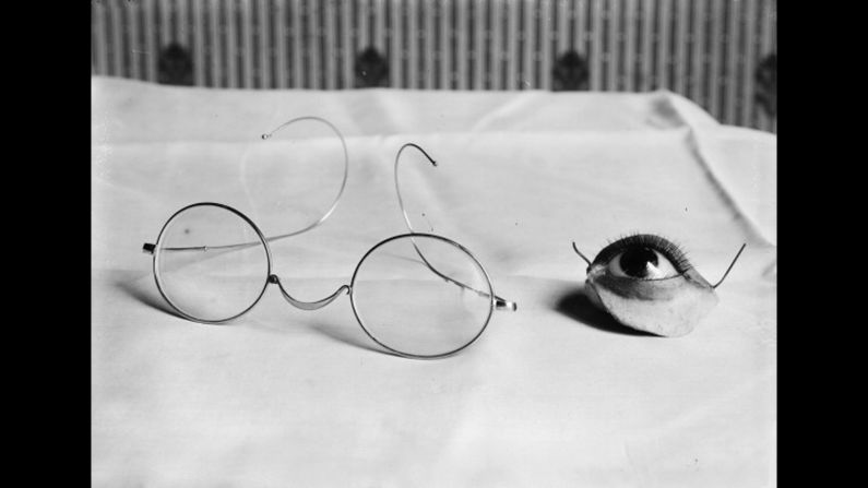 Prosthesis for eye and eyelid, to attach to glasses, France, 1916.