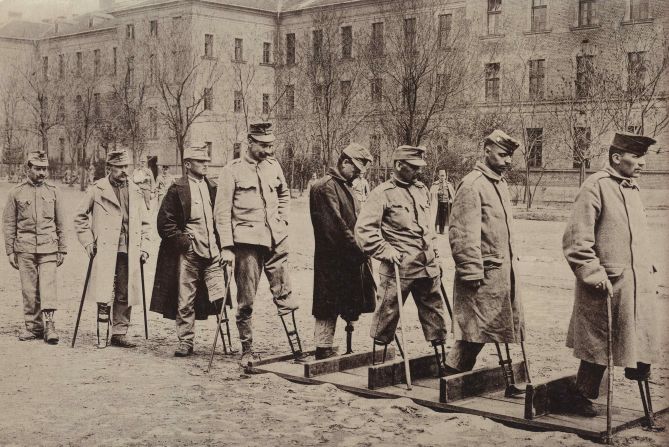 The scale and type of physical injuries endured by soldiers injured in World War One challenged the ingenuity of prosthesis designers, whose work to replace lost body parts would let many return to productive civilian life, a process echoed today with soldiers injured in our recent wars.  Here Austro-Hungarian soldiers practice walking with artificial legs at the First War Hospital, Budapest. See gallery showing the effects of the war.