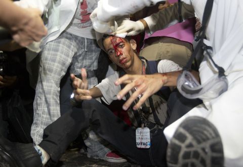 A demonstrator is assisted by paramedics after he was injured by a rock thrown during a march.