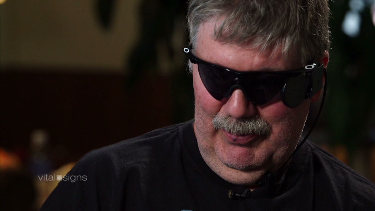 Roger Pontz was left completely blind by retinitis pigmentosa. In January 2014 he became the second person in the United States to get the implant. 