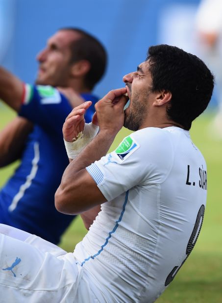 Suarez has previous on the biting front, having been banned for similar incidents in Holland and in England.