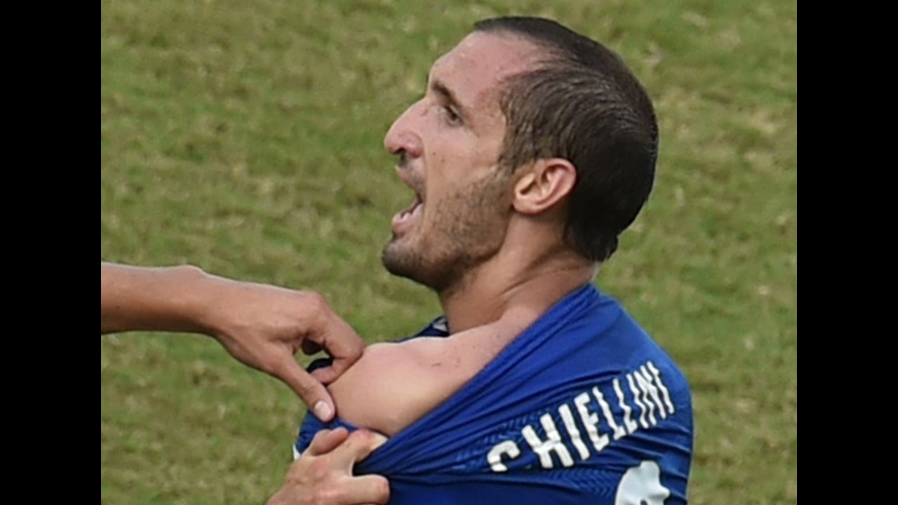Chiellini shows an apparent bite mark on his shoulder. "Suarez is a sneak, and he gets away with it because FIFA want their stars to play in the World Cup," Chiellini told Sky Sports Italia.