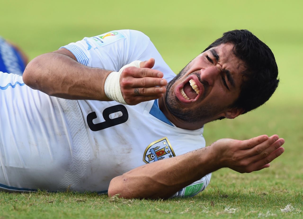 Uruguay soccer star Luis Suarez served a four-month suspension from the sport after he bit Italy defender Giorgio Chiellini on the shoulder during a World Cup game in June. He was also banned for nine international matches and fined $111,000.