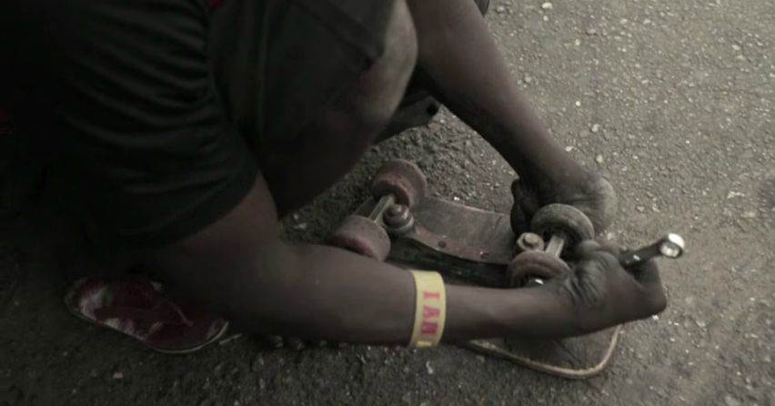 As the players are polio survivors, many have limited use of their legs. They instead play the game on homemade skateboards.