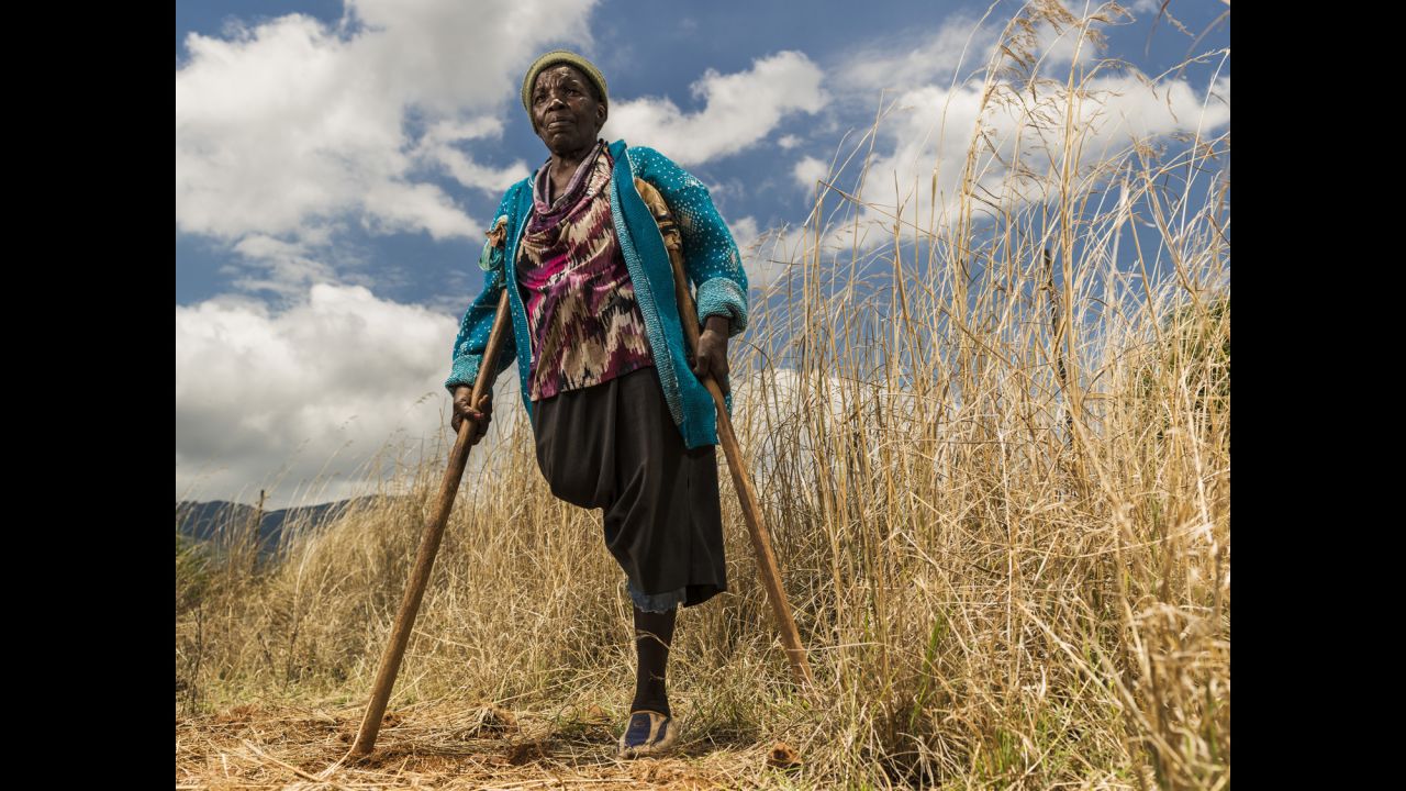 Requina Jimu lost her leg in 1987 to a land mine laid by Rhodesian forces at the Mozambique-Zimbabwe border in the 1970s. Her husband was killed by a land mine a year later. "Everything changed when I lost my leg," she said. "Now I am a beggar."