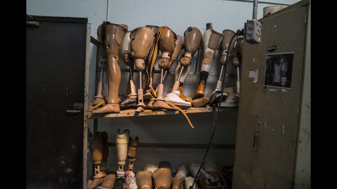 Shelves hold prosthetics at the Aldo Chavarria Hospital in Managua, Nicaragua.