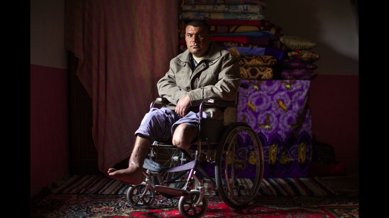 Bassim Miftin was working as a shepherd in 2004 when he stepped on a land mine in the Iraqi village of Zorbatya. He lost his left leg above the knee and injured his right foot.