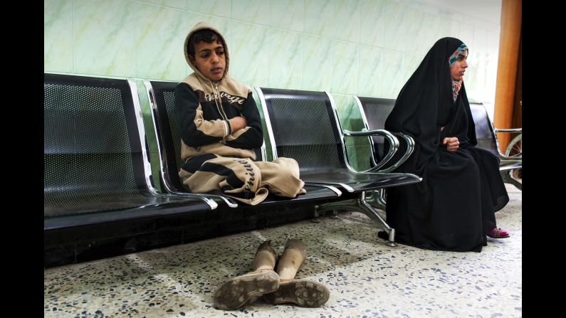 Sajad Faleh, 12, waits for his assessment at the rehabilitation center in Najaf. He lost both his legs to a land mine in 2006. He also lost two of his brothers in the blast.