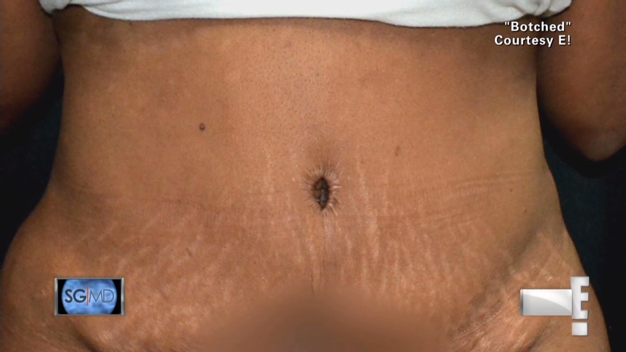 sgmd gupta botched plastic surgery_00003210.jpg