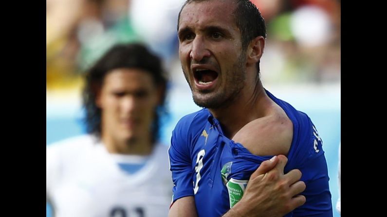 Italy's Giorgio Chiellini shows his shoulder to match officials, claiming he was bitten by Uruguay's Luis Suarez during a World Cup match Tuesday, June 24, in Natal, Brazil. After reviewing the incident, FIFA <a href="http://www.cnn.com/2014/06/26/sport/football/luis-suarez-banned-world-cup/">suspended Suarez</a> for four months. The punishment is the most severe ever handed out at a World Cup for an offense committed on the field of play.