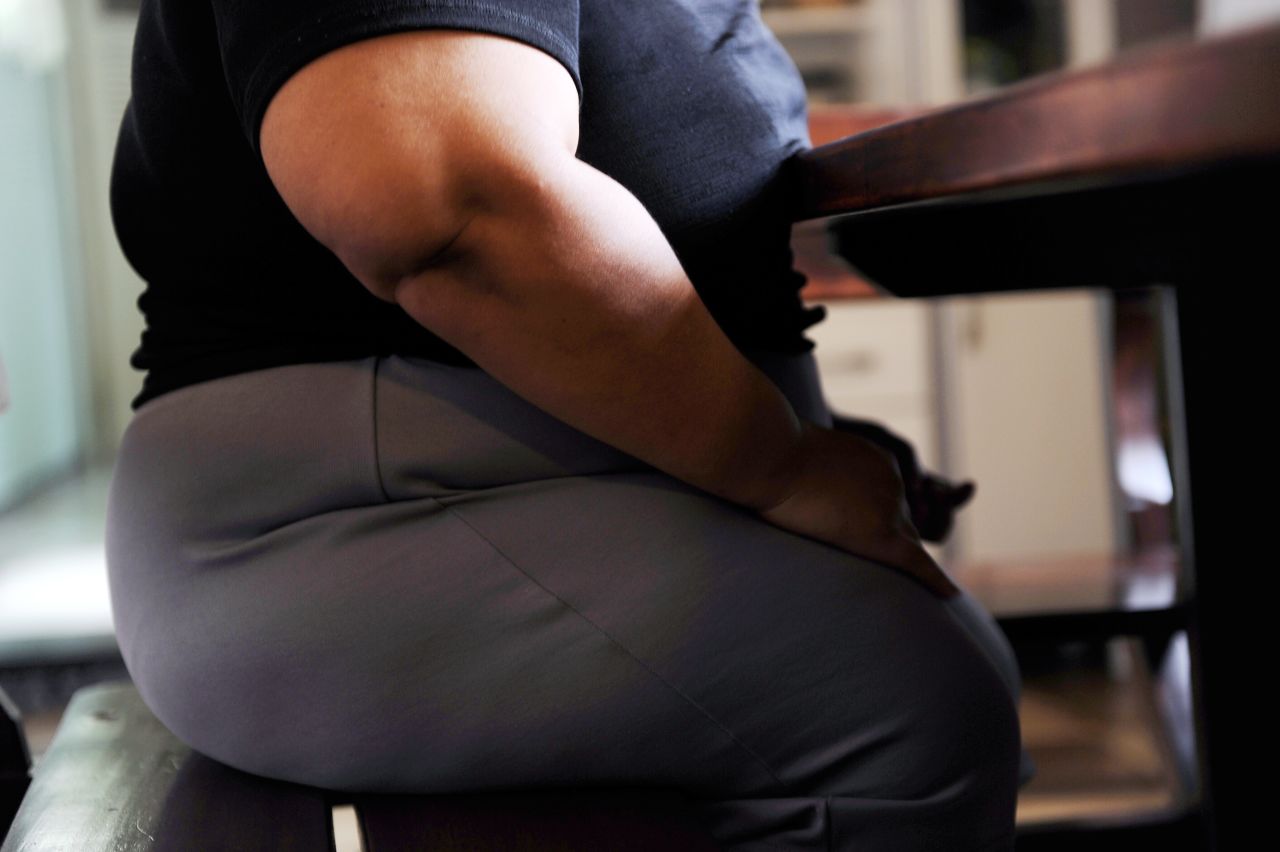 Esta mujer brasileña perdió 15 kilos en 50 días después de la cirugía bariátrica para reducir radicalmente el tamaño de su estómago. El cirujano bariátrico, Dr. Guilherme Cotta, dice que ahora lleva a cabo más de cinco veces el número de operaciones que hacía hace una década.