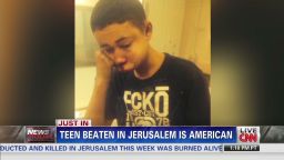 nr serfaty american teen beaten jerusalem_00001119.jpg