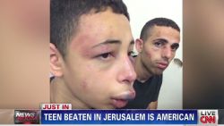 nr serfaty american teen beaten jerusalem_00001514.jpg