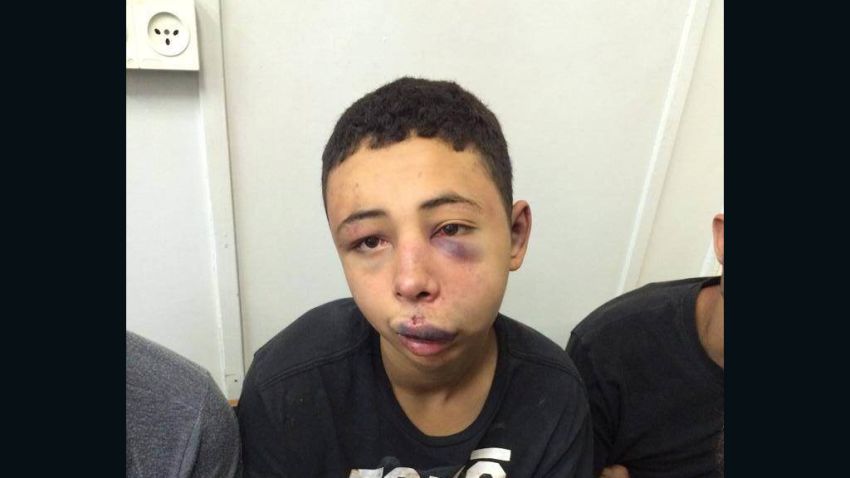 Tariq Khdeir teen beaten