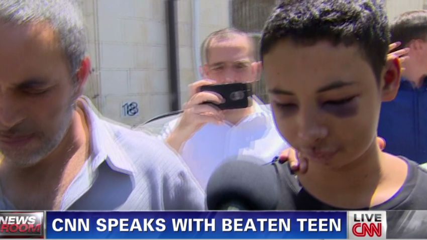 nr wedeman beaten teen house arrest_00001309.jpg