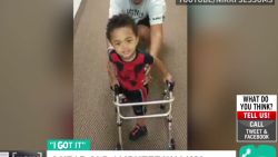 hln toddler amputee walks prosthetic leg mike vick_00003209.jpg