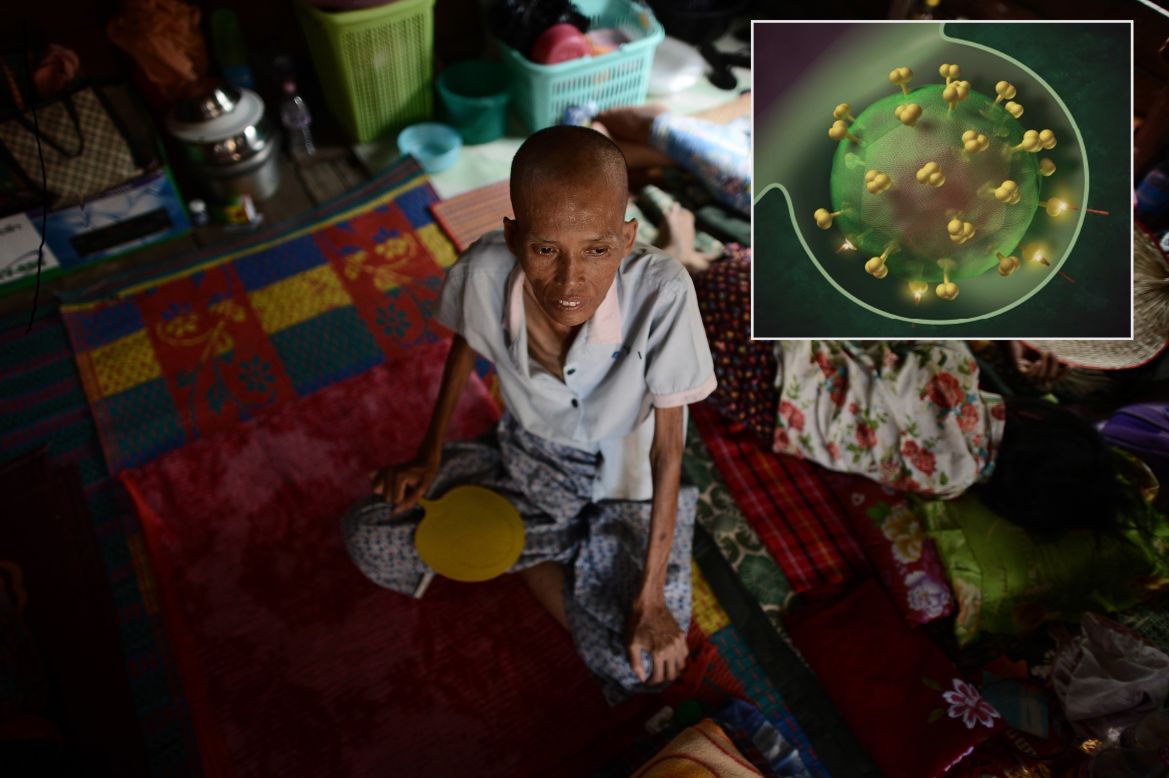 <strong>HIV</strong> (insert: Human immunodeficiency virus)<br /><br />The arrival of antiretroviral therapy changed the face of the HIV epidemic globally from a chronic, debilitating and inevitably fatal infection to one that can be managed to live a long and healthier life. <br /><br />But the virus reproduces rapidly, meaning resistant forms could easily form and multiply. Up to 14% resistance was found in high-income countries soon after antiretrovirals were introduced in the 1990s and increased use of treatment in developing countries has seen resistance emerge more globally. In 2012, 35 million people were estimated to be living with HIV, based on World Health Organization reports, and with over 2 million people newly infected in 2012, HIV could one day return to pandemic levels if resistance continues to spread.