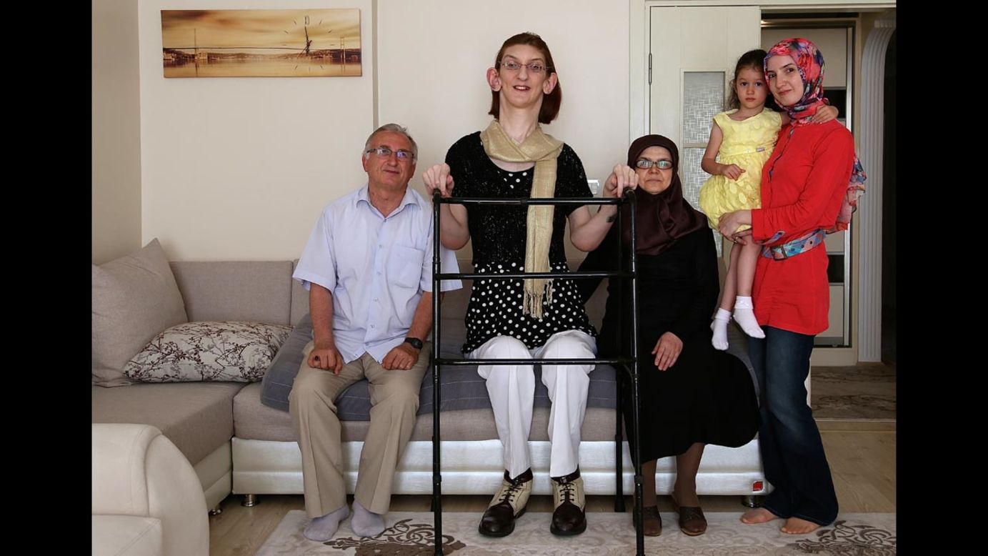 Rumeysa Gelgi, second from left, poses with her family at their home in Karabuk, Turkey, on Wednesday, July 9. Gelgi, a 17-year-old with a rare disorder called Weaver syndrome, was named the world's tallest girl by the Guinness Book of World Records. She is just over 7 feet tall.