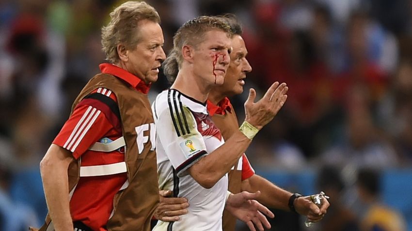 Bastian Schweinsteiger, con sangre en la cara tras chocarse contra Sergio Agüero.