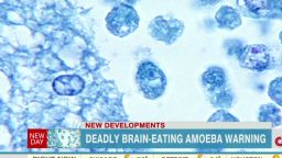 newday cohen deadly amoeba warning kansas_00001707.jpg