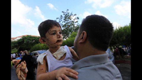 A Palestinian boy injured during an Israeli airstrike is taken to the hospital by his father in Gaza City on July 20.