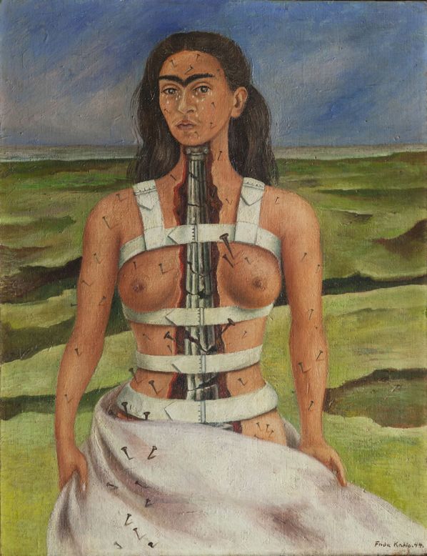 As a teenager, Kahlo suffered a horrific traffic accident which left her with lifelong health problems. Many of her self-portraits depict her in pain, such as 1944's "The Broken Column." 