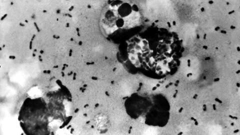 A smear shows the presence of the Yersinia pestis bacteria, which causes the plague. 