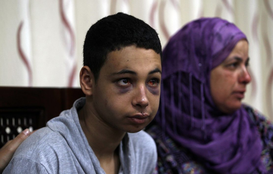 Beating victim Tariq Abu Khdeir is shown with the mother of  Mohammed Abu Khedair in the West Bank town of Ramallah.