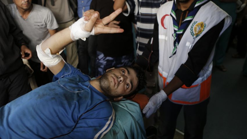 A Palestinian is wounded in an Israeli strike on a U.N. school in Beit Hanoun, in northern Gaza on July 24, 2014.